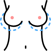 breast diagram