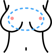 breast diagram uniboob