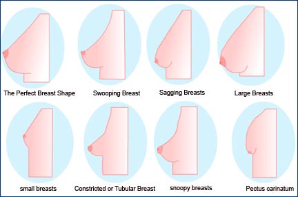 Tubular Breasts  Houston Plastic and Reconstructive Surgery