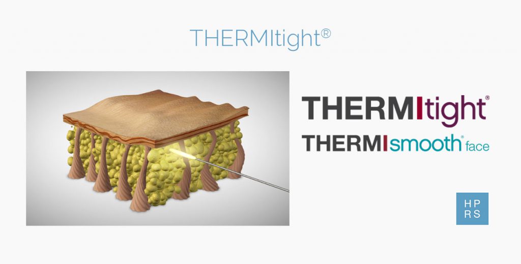 THERMItight®