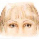 Eyelid Surgery Illustration