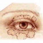 Eyelid Outlined Illustration