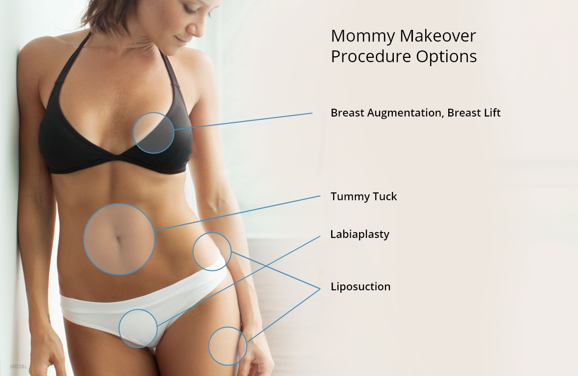 Mommy Makeover in Webster, TX | Houston Plastic & Reconstructive Surgery