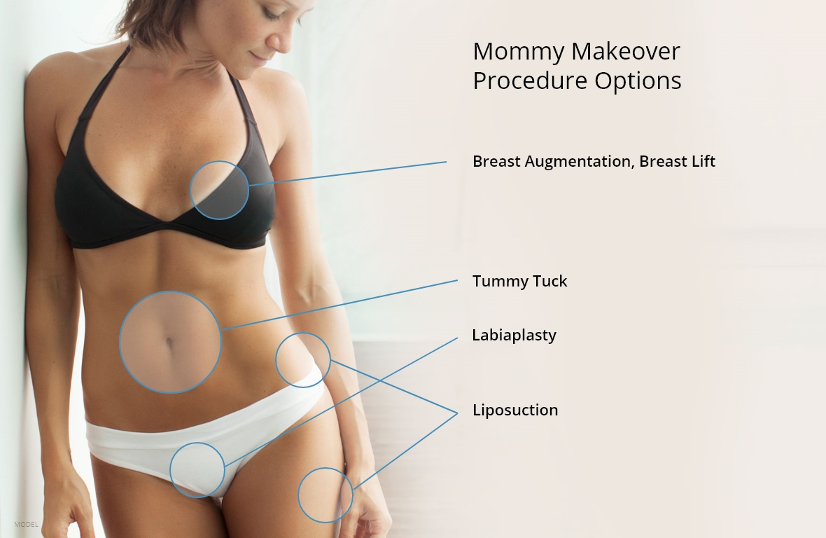 Mommy Makeover Procedure Options