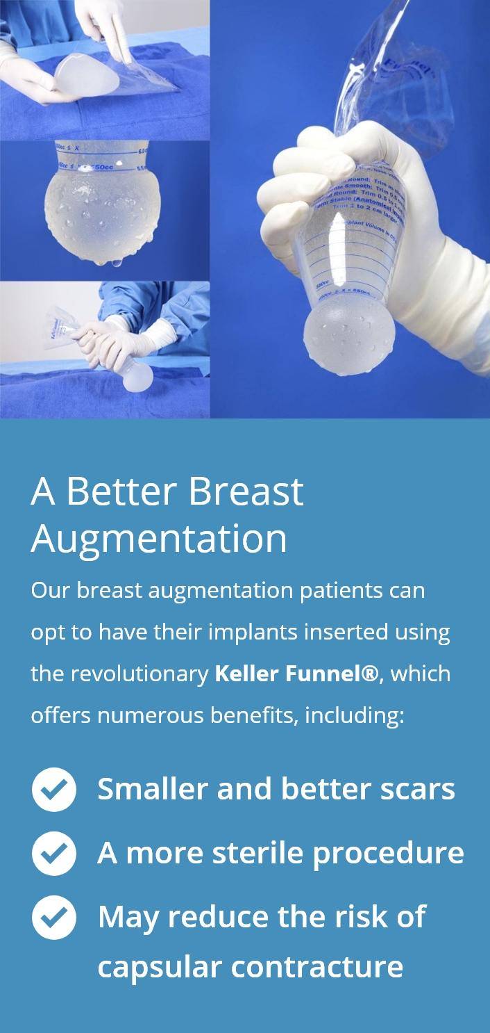a better breast augmentation diagram
